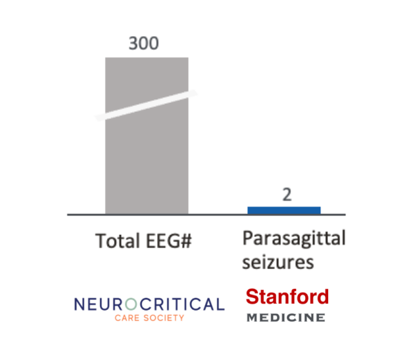 Ceribell montage EEG graphic